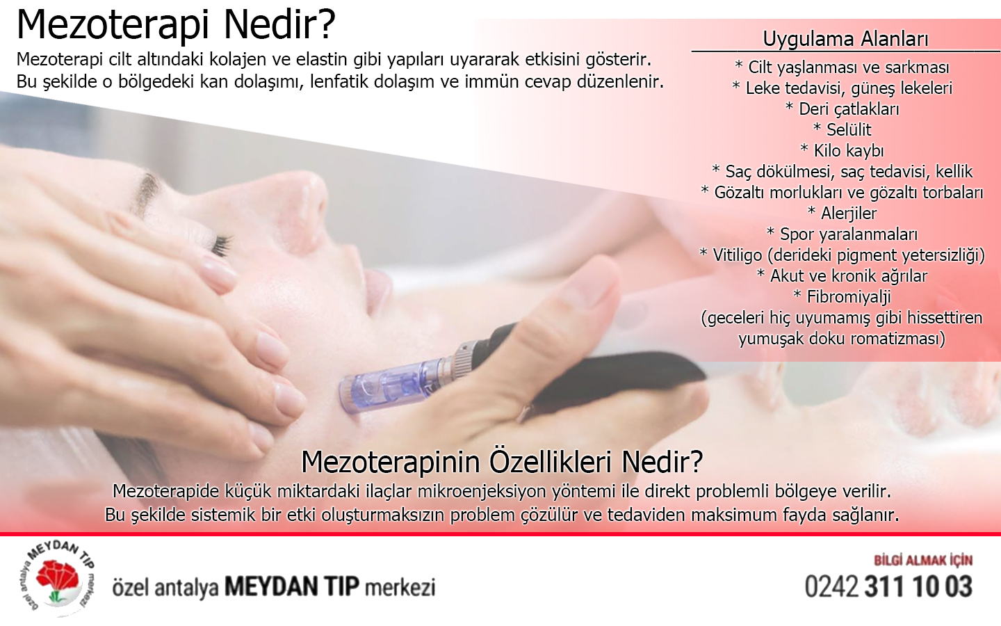 mezoterapi